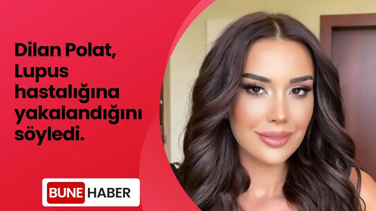 Dilan Polat Lupus hastalığına yakalandığını duyurdu