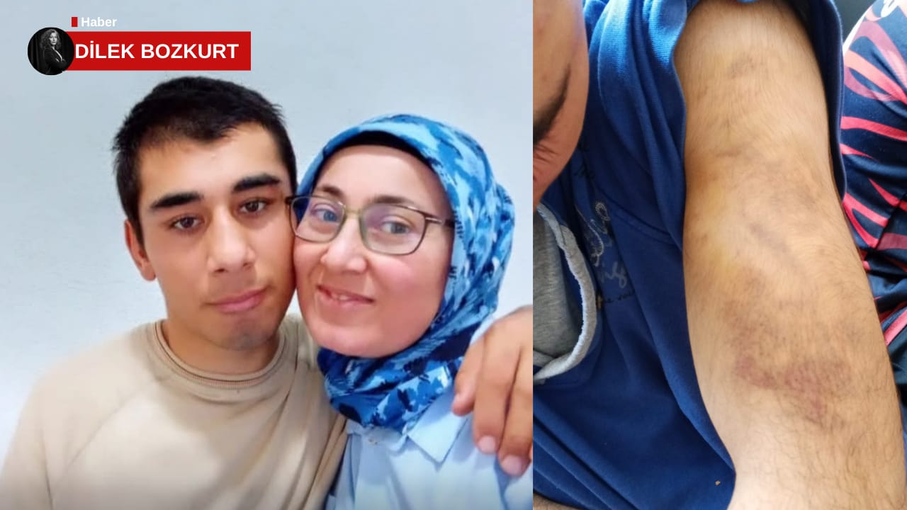 “Çocuklarımız Ölsün Diye Vermiyoruz, Canımız Yandı Başka Uğurlar Ölmesin!”